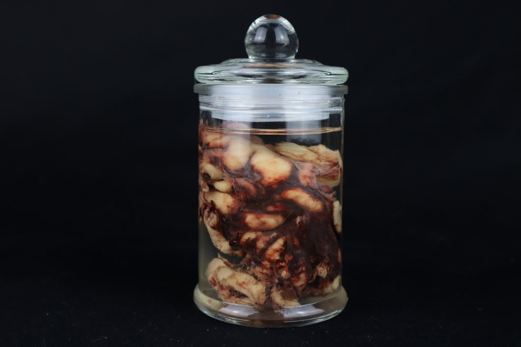 Wet Specimen Bison Brains