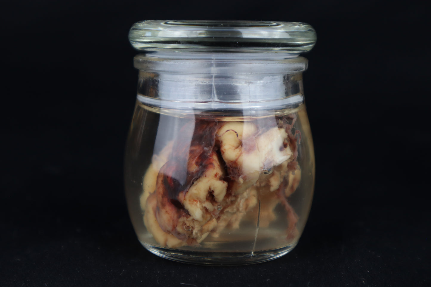 Wet Specimen Bison Brains
