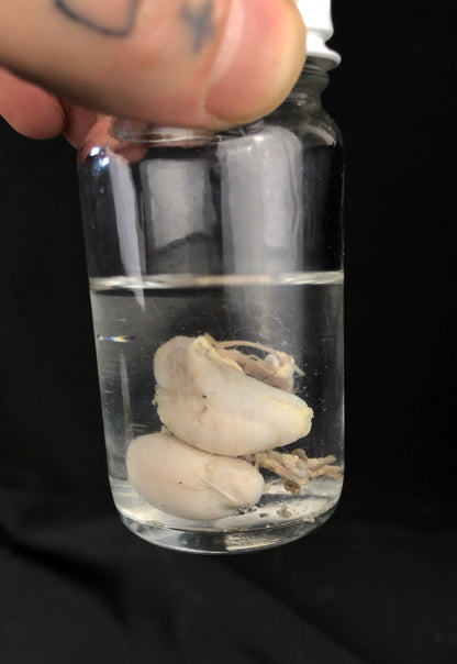 Reserved for Coffinherass - Wet Specimen Organ Collection